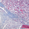 Endocrine