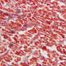 Endocrine
