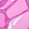 B52, Thyroid, 20x (H&E)