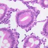 B12, Jejunum, 40x (H&E)