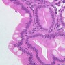 B12, Jejunum, 40x (H&E)