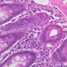 B12, Jejunum, 40x (H&E)