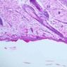 A49, Scalp (Skin), 10x (H&E)
