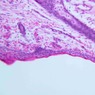 A49, Scalp (Skin), 20x (H&E)