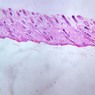 A49, Scalp (Skin), 2.5x (H&E)