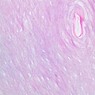 A50, Finger (Skin), 40x (H&E)