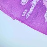 A55, Lip (Internal), 10x (H&E)