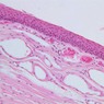 A67, Epiglottis, 20x (H&E)