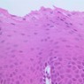 B2, Esophagus, 20x (H&E)