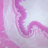 B2, Esophagus, 2x (H&E)