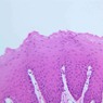 B2, Esophagus, 40x (H&E)