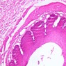 B2, Esophagus, 10x (H&E)