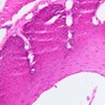 B2, Esophagus, 20x (H&E)