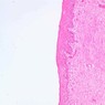 B98, Vagina, 10x (H&E)