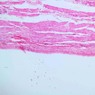 B76, Bladder, 10x (H&E)
