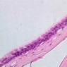 A75, Trachea, 40x (H&E)