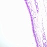A76, Trachea, 10x (H&E)