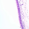 A76, Trachea, 20x (H&E)
