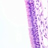 A76, Trachea, 40x (H&E)
