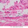 Epithelium