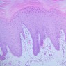 Epithelium