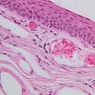 Epithelium