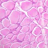Epithelium