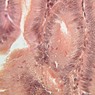 Epithelium