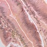 Epithelium