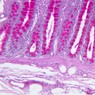 Epithelium