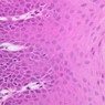 Epithelium