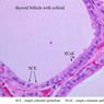 Epithelium