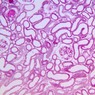 Epithelium