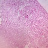 Epithelium