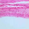 Epithelium