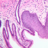 B1, Esophagus, 20x (H&E)