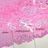 B1, Esophagus, 2.5x Labeled (H&E)