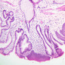 B1, Esophagus, 10x (H&E)