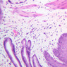 B1, Esophagus, 20x (H&E)