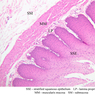 B2, Esophagus, 10x Labeled (H&E)
