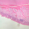 B10, Pyloroduodenal Junction, 2.5x (H&E)