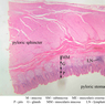 B10, Pyloroduodenal Junction, 2.5x Labeled (H&E)