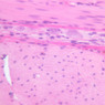 B10, Pyloroduodenal Junction, 40x (H&E)