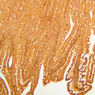B11, Pyloroduodenal Junction, 10x (Ag)