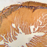 B11, Pyloroduodenal Junction, 2.5x (Ag)