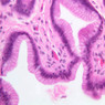 B1, Stomach (Cardiac), 40x (H&E)