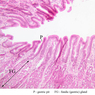 B4, Stomach (Fundus), 10x Labeled (H&E)