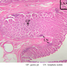 B4, Stomach (Fundus), 2.5x Labeled (H&E)