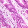 B4, Stomach (Fundus), 40x (H&E)