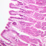 B4, Stomach (Fundus), 10x (H&E)
